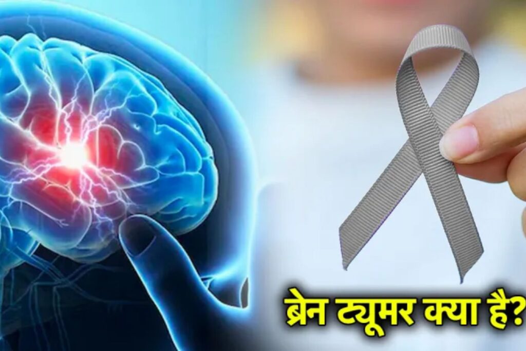 Brain Tumor