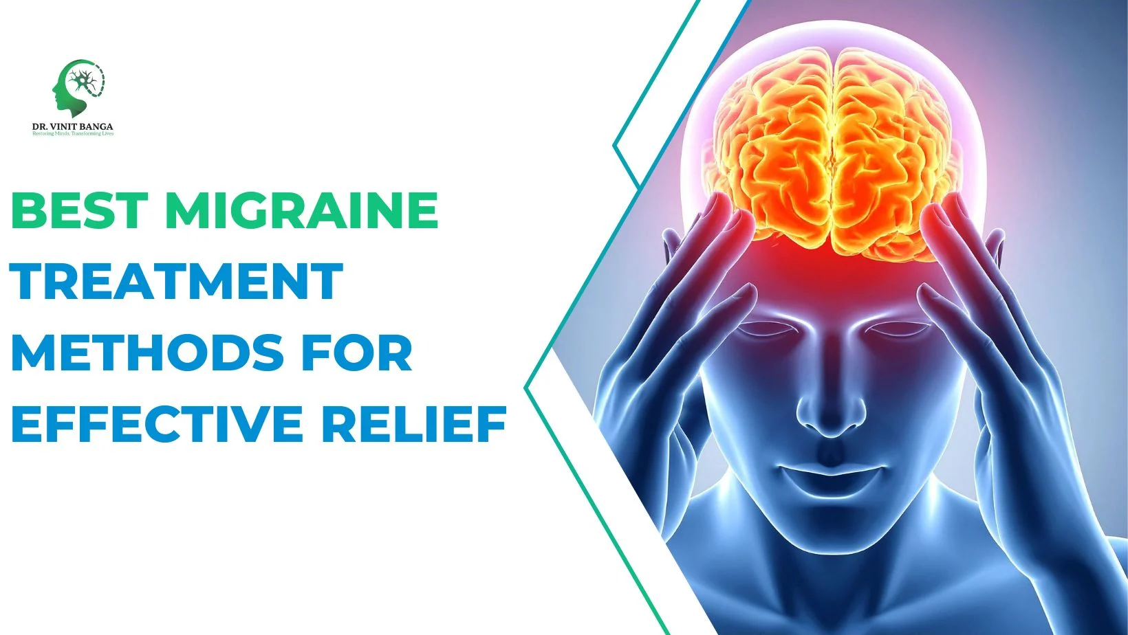 Best Migraine Treatment Methods for Effective Relief