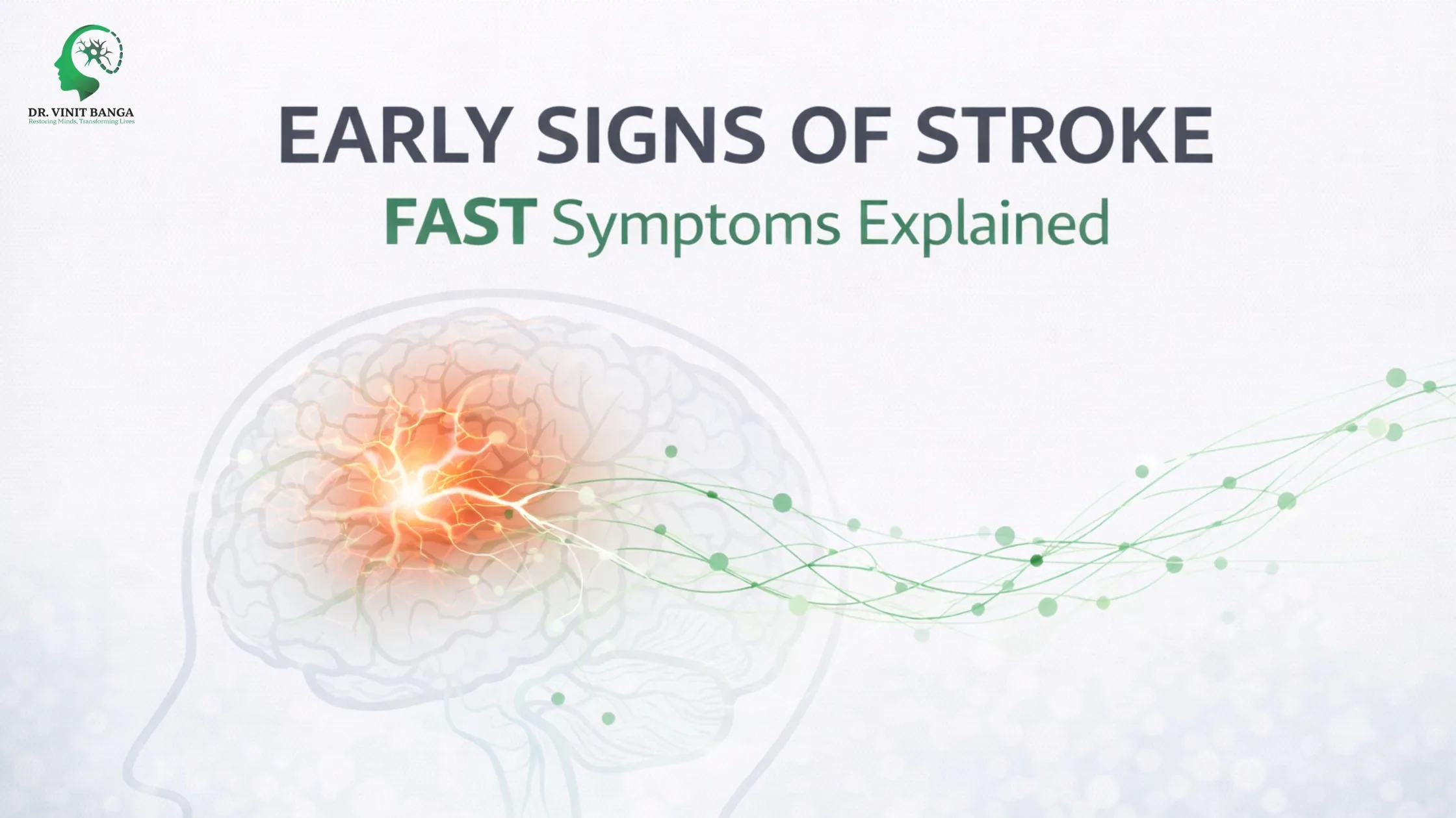 Early Signs of Stroke: FAST Symptoms Explained